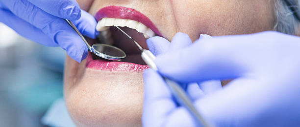 Best Pediatric Emergency Dentist in York, SC